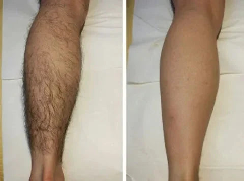 SanftHaut™ Lang anhaltendes geschmeidiges Selbstvertrauen