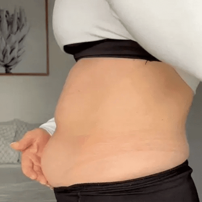 HautStraff™ Nahtlose Festigkeitskontrolle